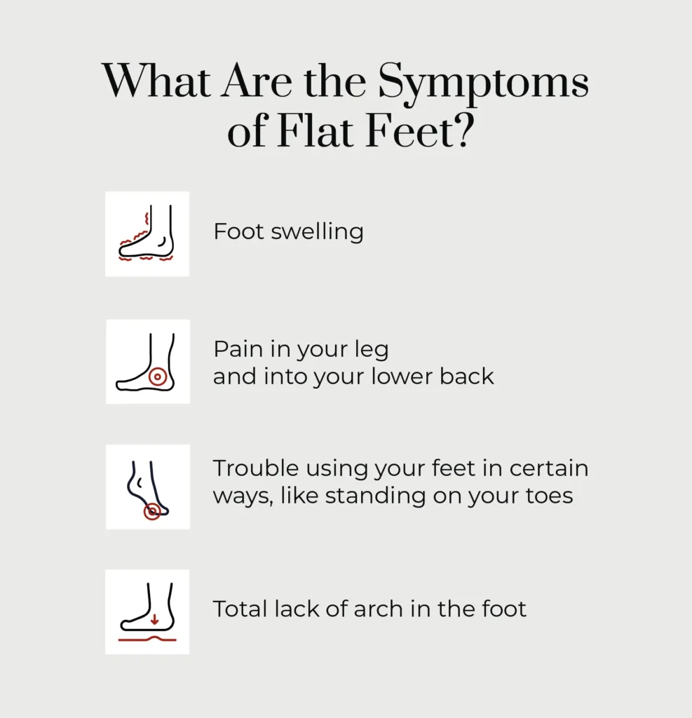 A list of flat feet symptoms. 
