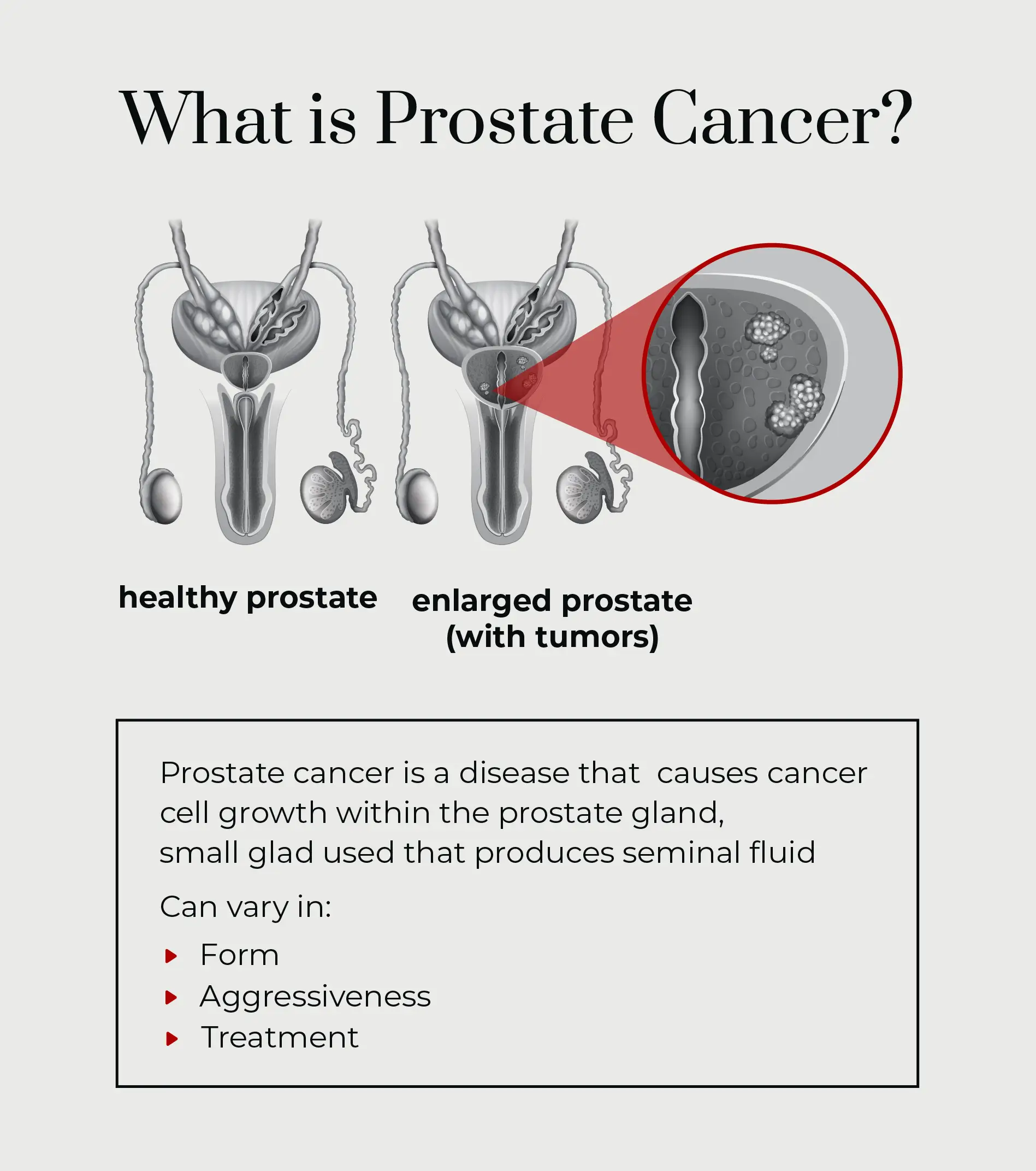 prostate VA Disability for Prostate Cancer -