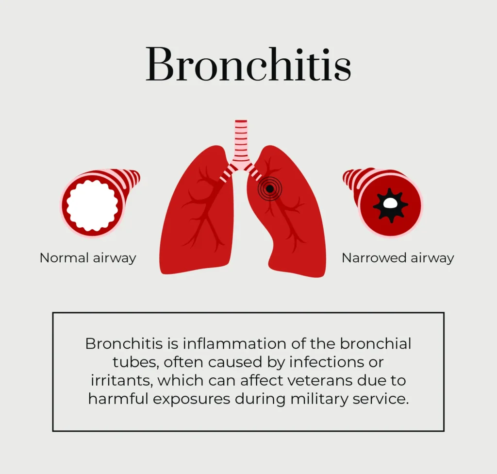 Bronchitis VA Rating