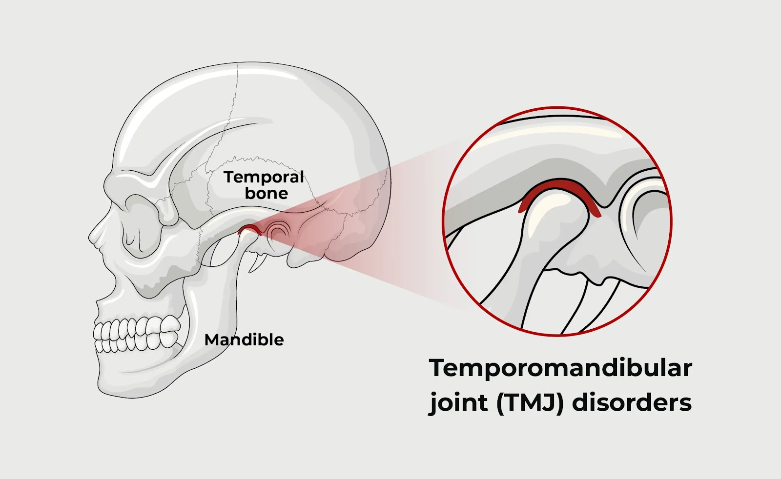image of the temporal bone