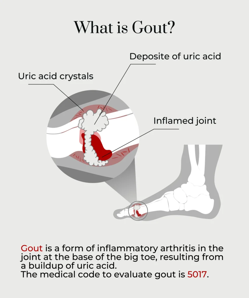 A graphic describing what gout is.