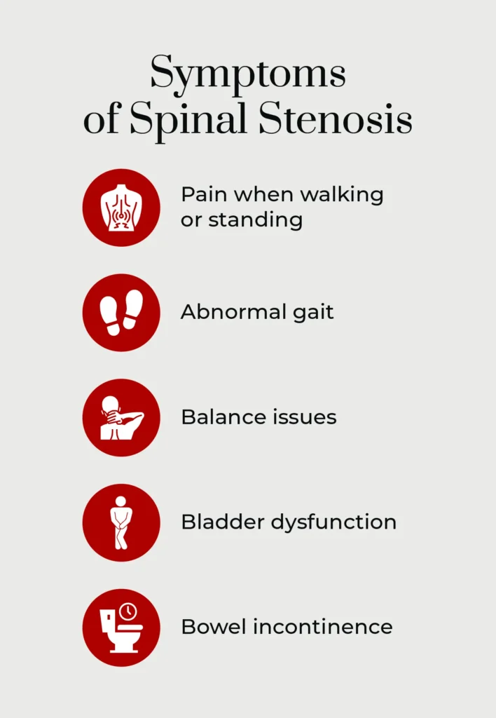 An infographic listing out the symptoms of spinal stenosis.